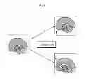 Fig. 08 - Apparatus and method for correcting artifacts of functional image acquired by magnetic resonance imaging