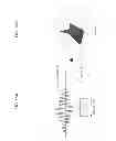 Fig. 17 - Apparatus and method for correcting artifacts of functional image acquired by magnetic resonance imaging