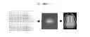 Fig. 18 - Apparatus and method for correcting artifacts of functional image acquired by magnetic resonance imaging