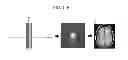 Fig. 19 - Apparatus and method for correcting artifacts of functional image acquired by magnetic resonance imaging