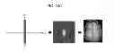 Fig. 20 - Apparatus and method for correcting artifacts of functional image acquired by magnetic resonance imaging