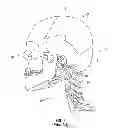 Fig. 02 - Method and system of measuring anatomical features in subcutaneous images to assess risk of injury