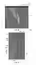 Fig. 07 - Method and system of measuring anatomical features in subcutaneous images to assess risk of injury
