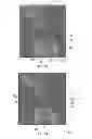 Fig. 08 - Method and system of measuring anatomical features in subcutaneous images to assess risk of injury