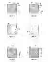 Fig. 17 - Method and system of measuring anatomical features in subcutaneous images to assess risk of injury