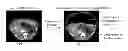 Fig. 01 - System and method for registering pre-operative and intra-operative images using biomechanical model simulations
