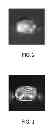 Fig. 03 - Apparatus for generating assignments between image regions of an image and element classes