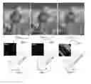 Fig. 01 - De-noising image content using directional filters for image de-blurring