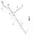 Fig. 02 - Systems and methods for treating hollow anatomical structures