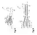 Fig. 09 - Systems and methods for treating hollow anatomical structures