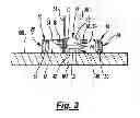 Fig. 04 - ANCHOR DEVICE