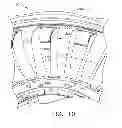 Fig. 08 - Double fan outlet guide vane with structural platforms