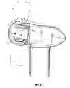 Fig. 03 - Wind turbine generator with localized air gap control and a wind turbine having such a generator