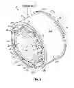 Fig. 04 - Wind turbine generator with localized air gap control and a wind turbine having such a generator