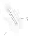 Fig. 07 - Suppressor device