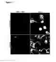 Fig. 07 - Optical imaging probes