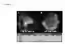 Fig. 04 - COMPOSITIONS AND METHODS FOR AUDITORY THERAPY