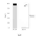 Fig. 49 - Animal models and therapeutic molecules