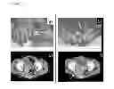 Fig. 02 - EGFR targeted therapy
