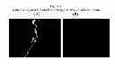 Fig. 09 - Methods and compositions for wound treatment