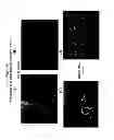 Fig. 10 - Methods and compositions for wound treatment