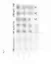 Fig. 04 - RECOMBINANT VACCINES AND USE THEREOF