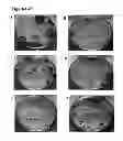 Fig. 07 - Compositions, methods and uses for dengue virus serotype-4 constructs