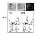 Fig. 06 - Individualized cancer therapy