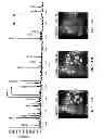 Fig. 07 - Individualized cancer therapy