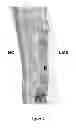 Fig. 05 - Methods of enhancing wound healing using magnesium and bromide