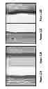 Fig. 12 - Methods of enhancing wound healing using magnesium and bromide