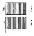 Fig. 13 - Methods of enhancing wound healing using magnesium and bromide
