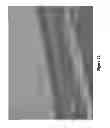 Fig. 23 - Methods of enhancing wound healing using magnesium and bromide