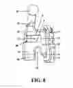Fig. 09 - Orthodontic self-ligating brackets
