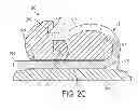 Fig. 04 - BIOCOMPATIBLE SELF-LIGATING BRACKETS