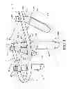 Fig. 02 - Dental Prosthesis With Reference Points For Imaging When Fabricating A Denture