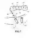 Fig. 06 - Dental Prosthesis And Fabrication