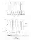 Fig. 06 - Systems and methods for the predictive assessment and neurodevelopment therapy for oral feeding