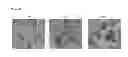 Fig. 03 - USE OF PROTEIN NANOPARTICLE BASED HYDROGEL