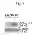 Fig. 04 - Method for determining depression, kit for analyzing serotonin transporter, and kit for analyzing ubiquitinated serotonin transporter in blood