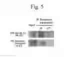 Fig. 06 - Method for determining depression, kit for analyzing serotonin transporter, and kit for analyzing ubiquitinated serotonin transporter in blood