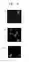 Fig. 09 - METHOD OF ISOLATING OR COUNTING TARGET CELLS BY USING PHOTOCLEAVABLE LINKER COUPLED WITH FLUORESCENT DYE