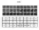Fig. 02 - Method for detecting the presence of carbapenemase-producing bacteria in a sample