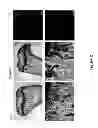 Fig. 03 - Genetically modified non-human animals and methods of use thereof