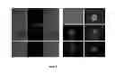 Fig. 13 - Method of extracting neural stem cells using nanoparticles