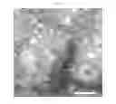 Fig. 07 - Simplified Compositions and Methods for Generating Neural Stem Cells From Human Pluripotent Stem Cells