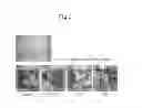 Fig. 04 - Plant Cell Differentiation Promoter