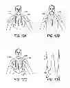 Fig. 12 - Body surfing suit