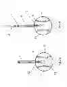 Fig. 04 - BASEBALL PITCHING TRAINING DEVICE