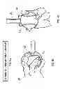 Fig. 11 - BASEBALL PITCHING TRAINING DEVICE